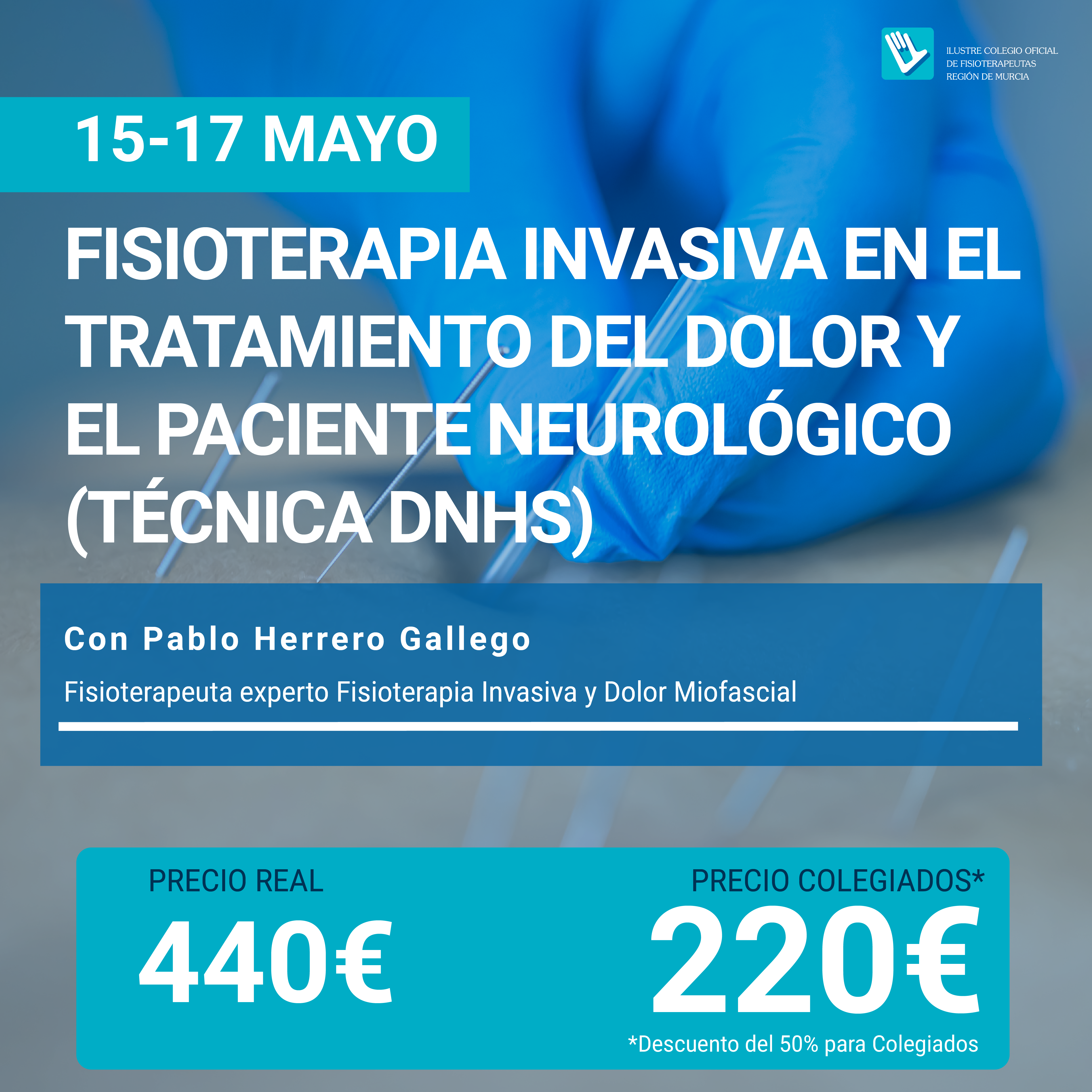 Punción seca en paciente neurológico. Método DNHS.