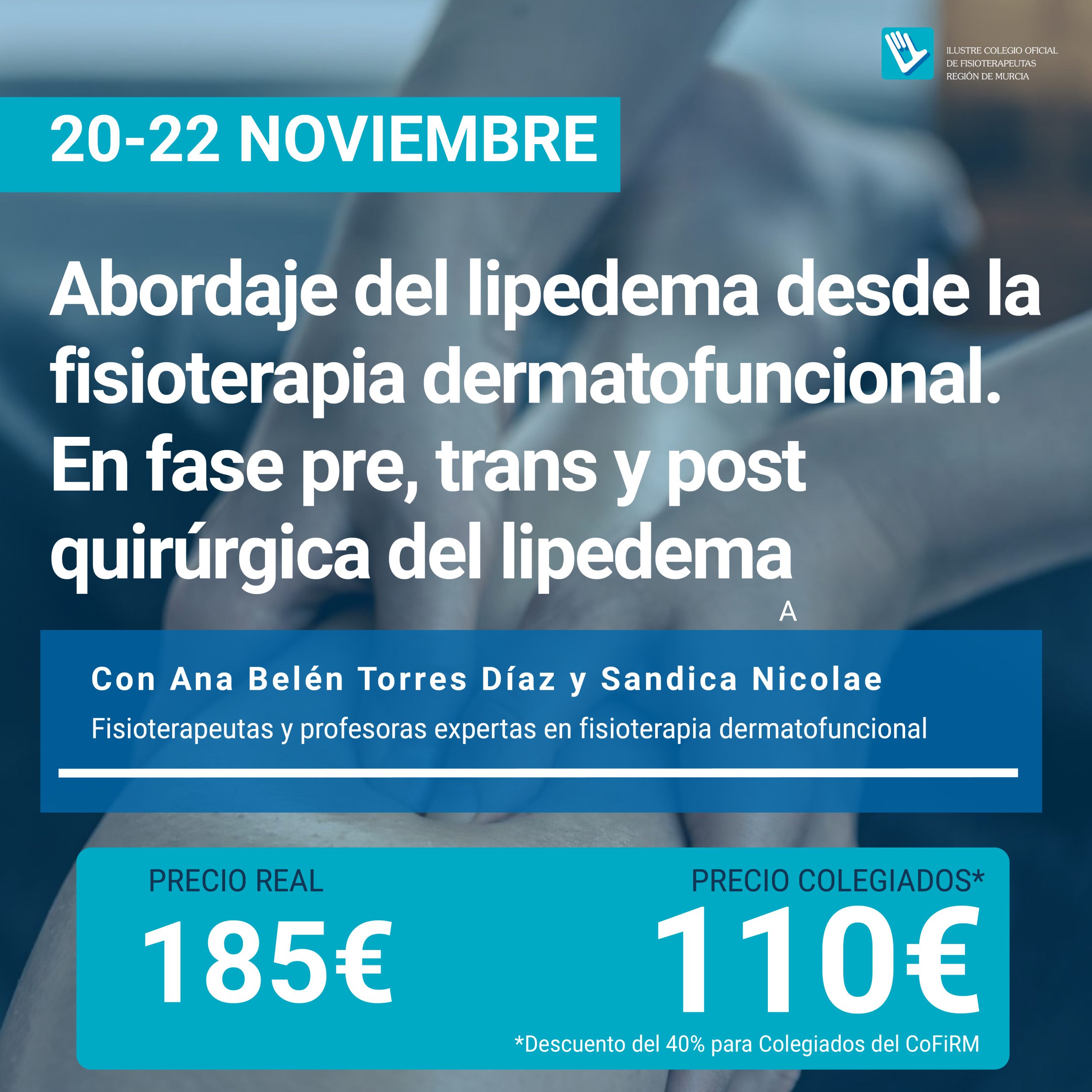 Abordaje del lipedema desde la fisioterapia dermatofuncional. En fase pre, trans y post quirúrgica del lipedema